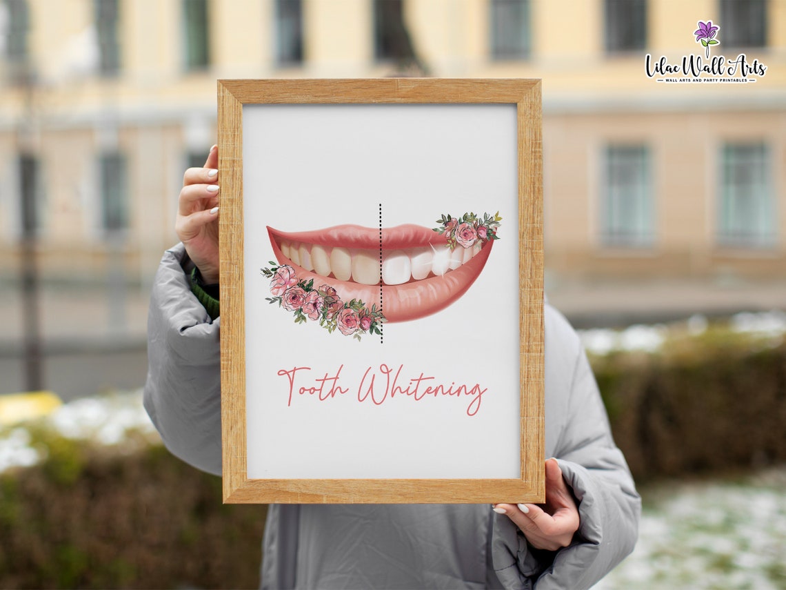 Tooth Whitening Pink Rose Smile Glow Cheerful Dentist Decor Art Poster - Image 4