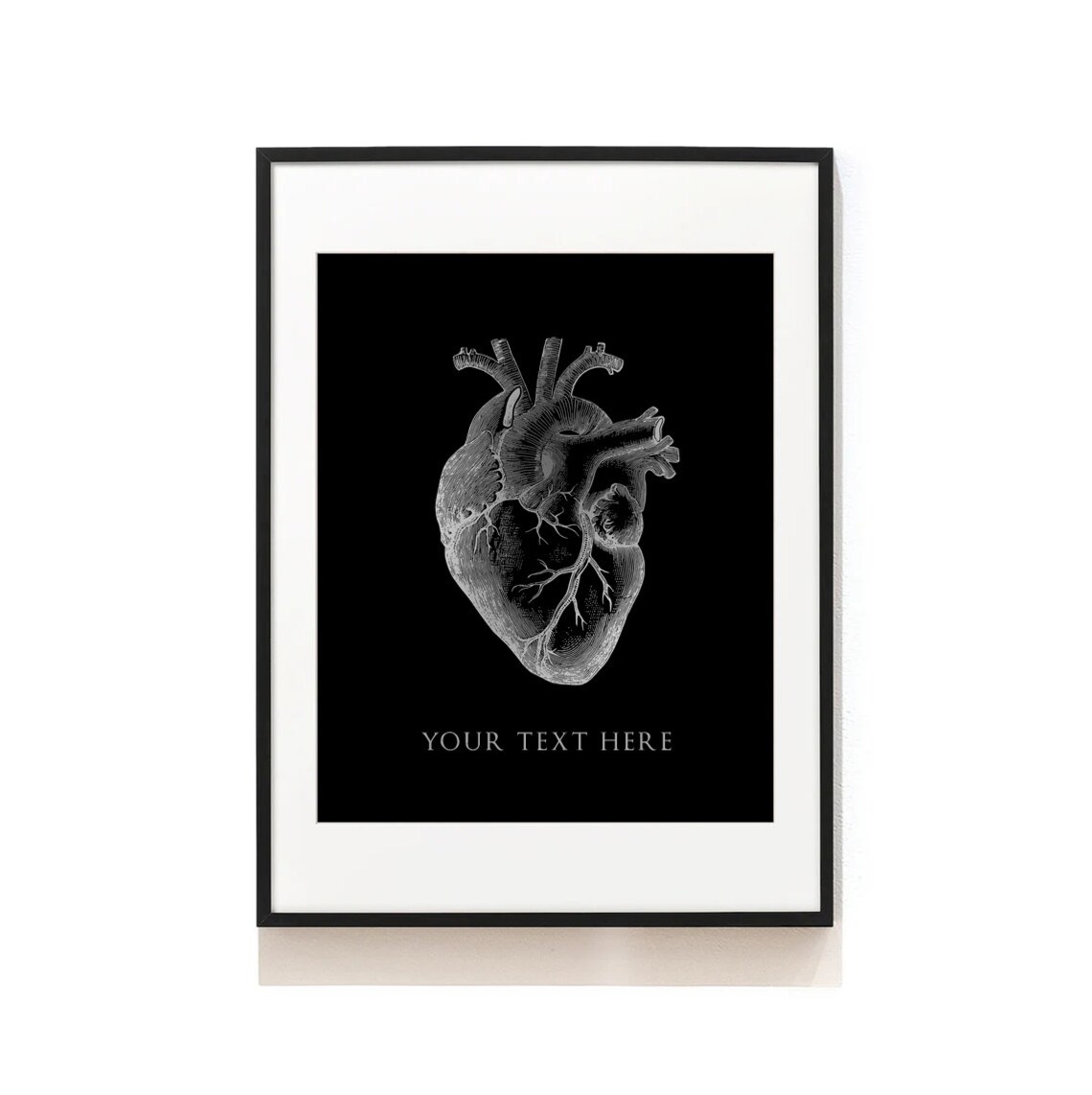 Custom Anatomical Heart Art Print for Cardiology - Image 5