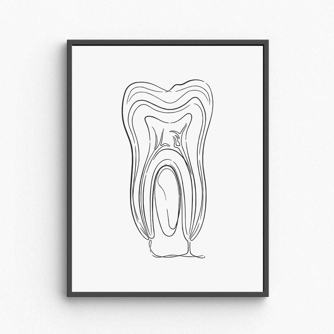 Tooth Anatomy Line Art Dental Medical Illustration Minimalist Poster