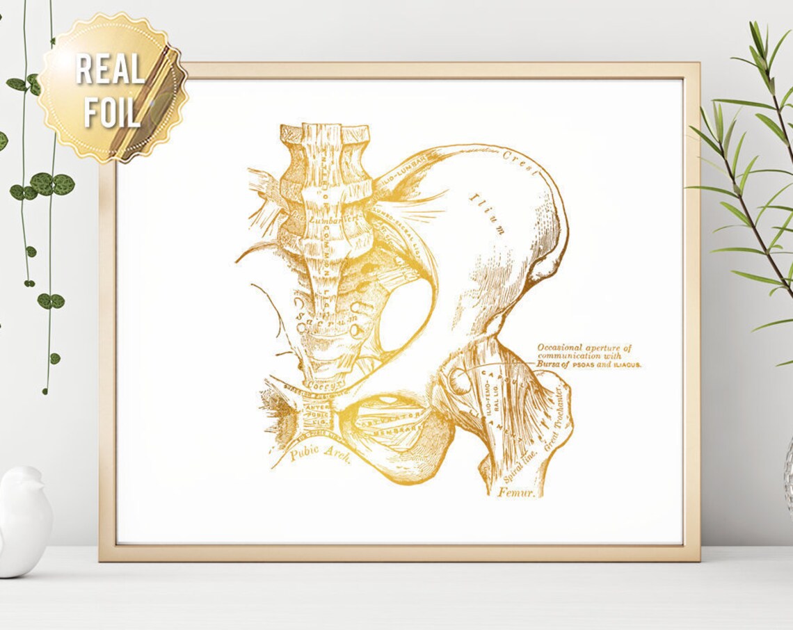 Gold Foil Pelvis Hip Bone Anatomy Vintage Orthopedic Art Print - Image 3