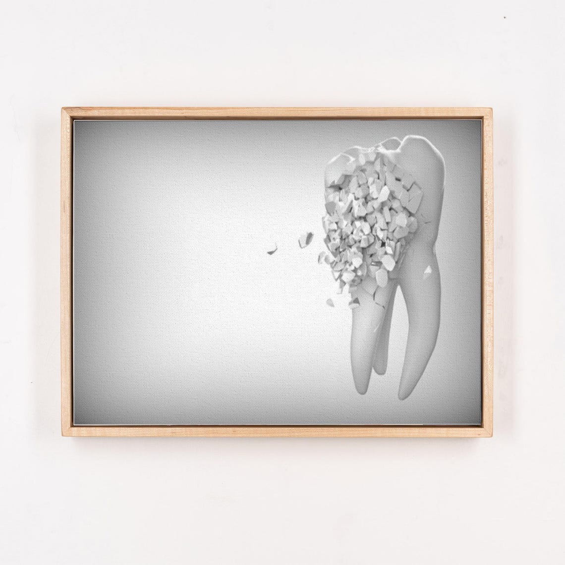 Decaying Tooth Crumbling Into Particles Minimal Dental Art Poster - Image 4