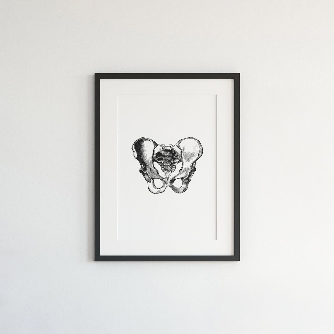 Hips Anatomy Print, Vintage Medical Wall Art